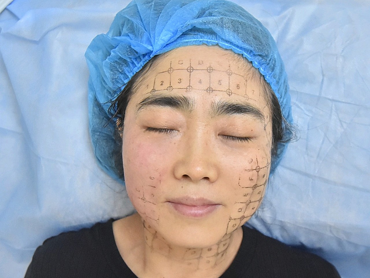 俪人热玛吉术后2天今天俪人小护士给我发了做完热玛吉_圈子-新氧美容