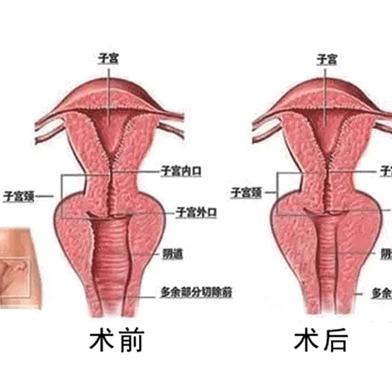 部位由于生理功能特殊,饱经生产,性史,月经等过_圈子-新氧美容整形