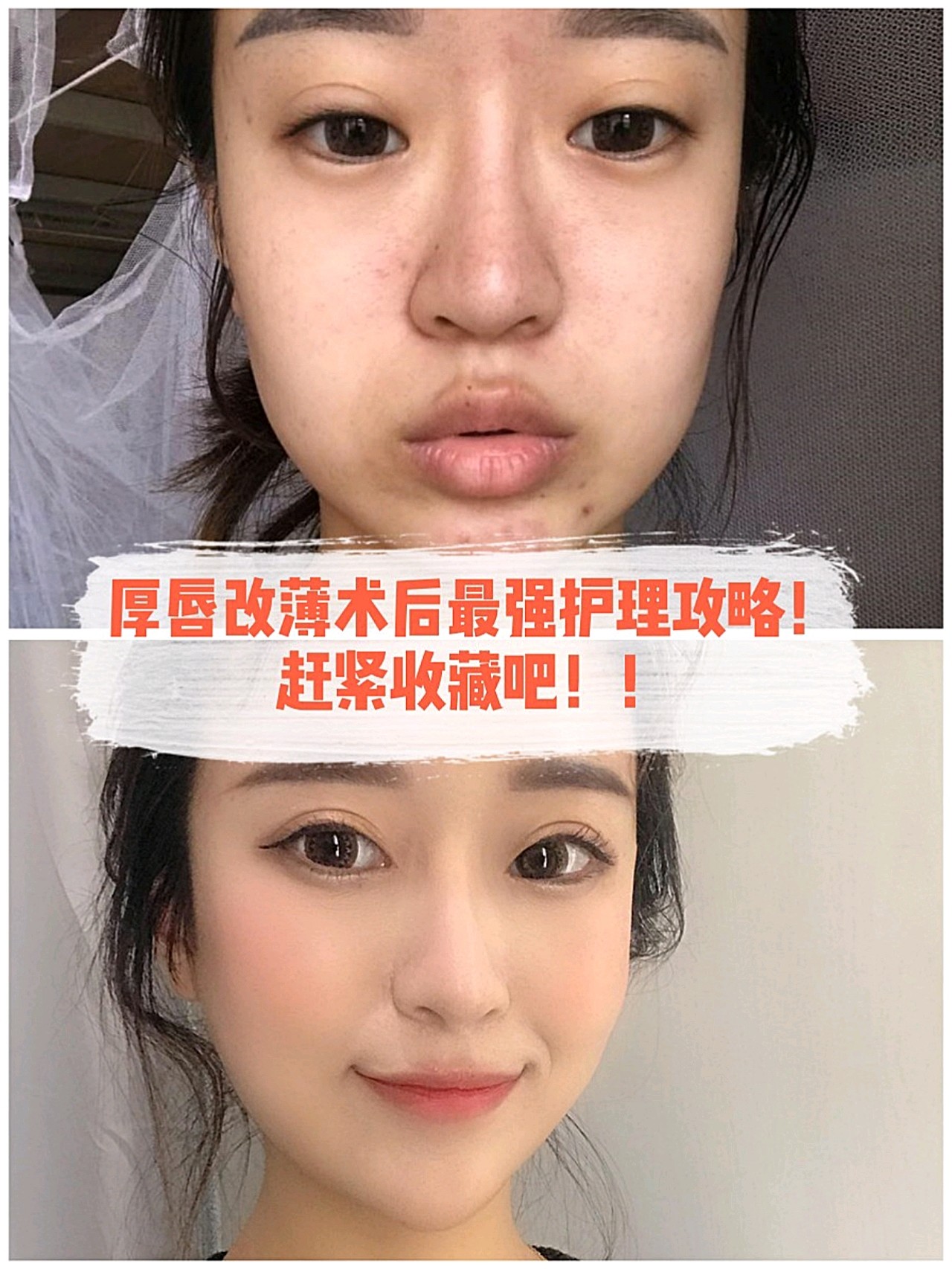嘴唇过厚,容易给人一种固执,笨拙的感觉,如果这种嘴形长在女人脸上