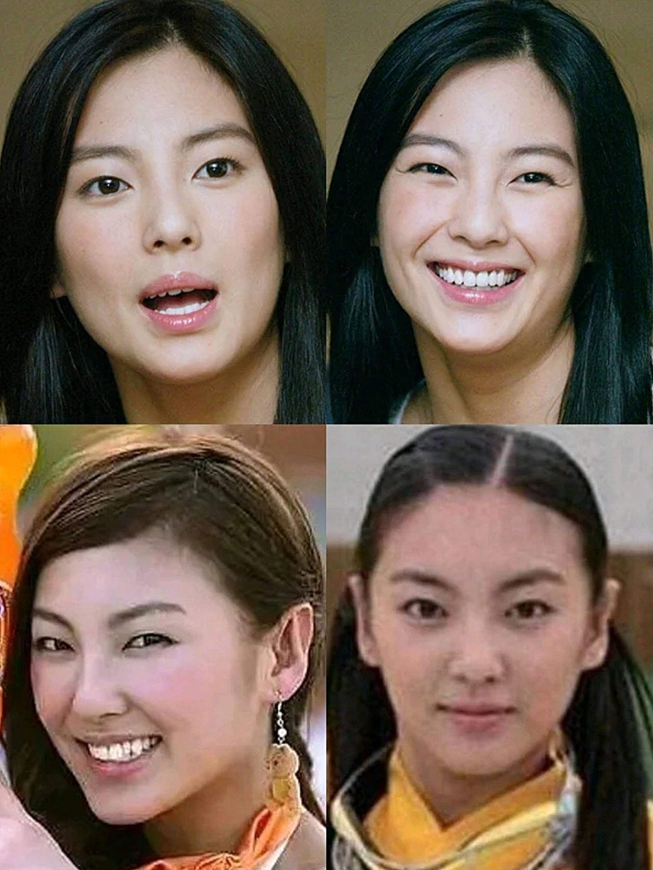 张雨绮双眼皮的蜕变史757575