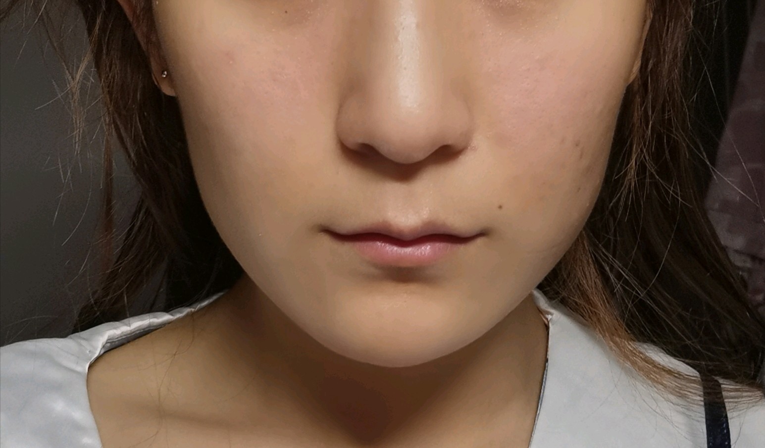 正面明显能看出来颧骨和下面咬肌之间凹进去是不是咬肌太大了啊显得脸