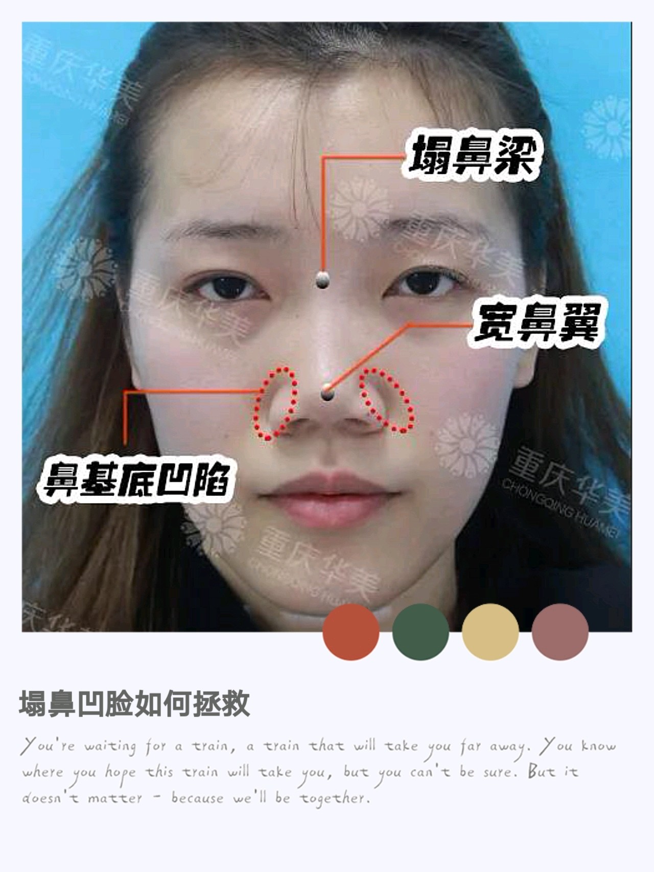 中面部凹陷_圈子-新氧美容整形