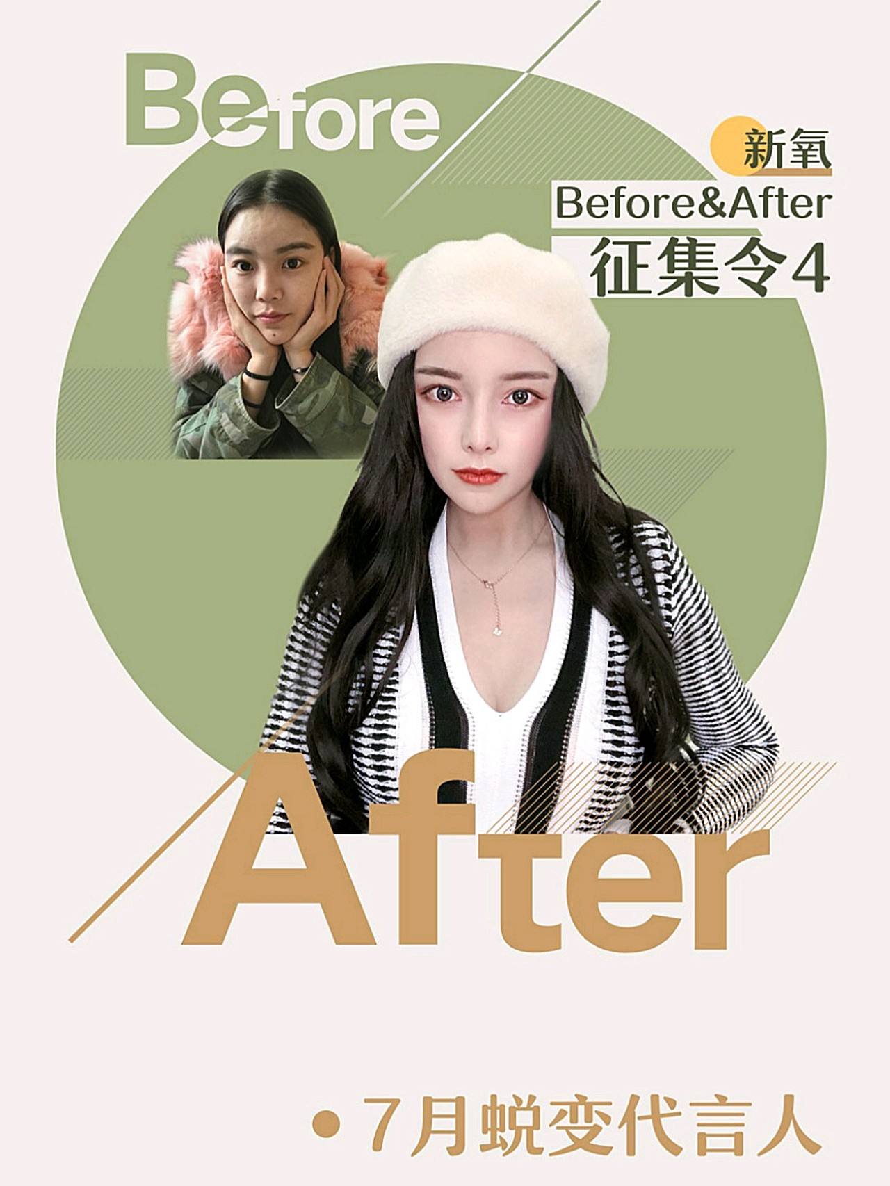 这个图片,我刚进来的时候懵逼了,特像我以前喜欢的那_圈子-新氧美容