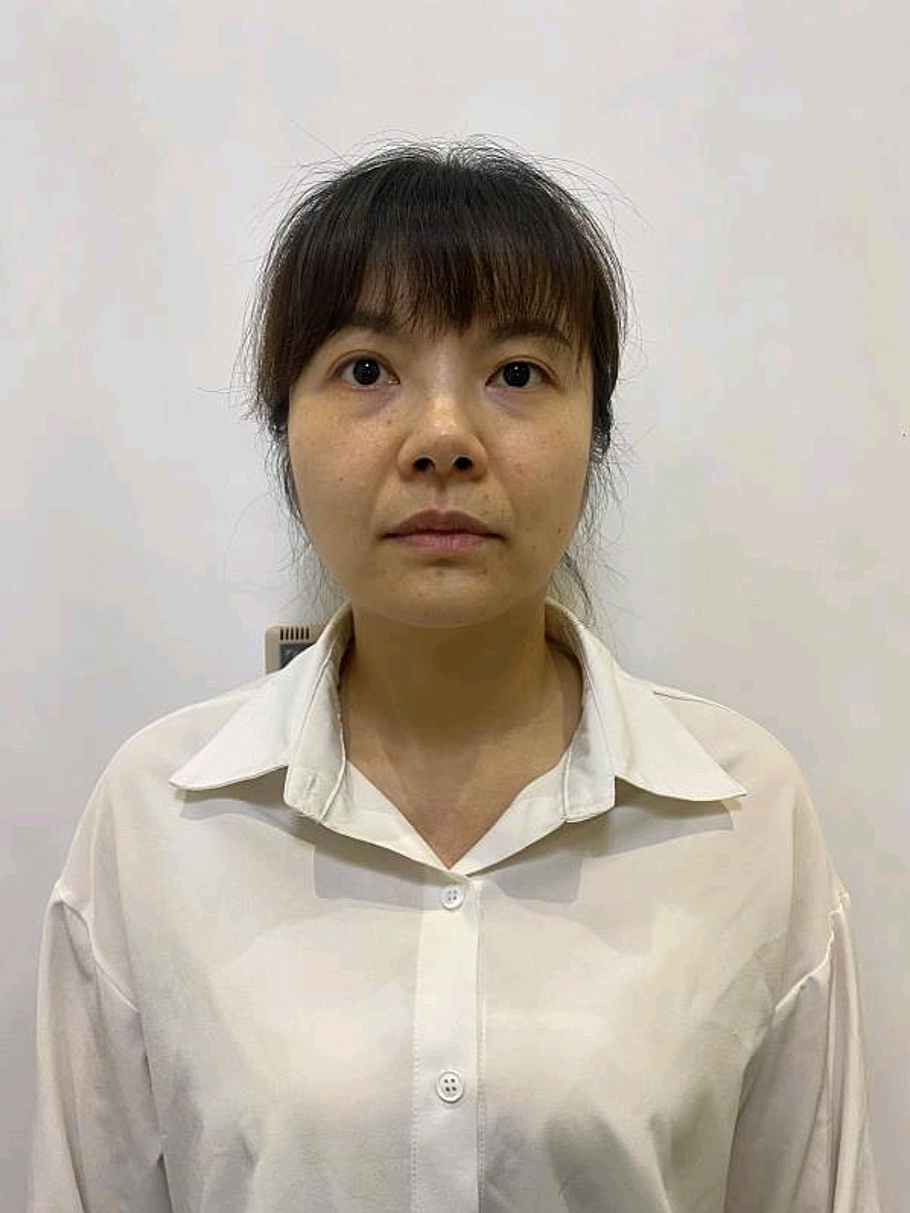 术前:跟同龄人相比越发觉得自己的脸开始下垂了,皮肤_圈子-新氧美容