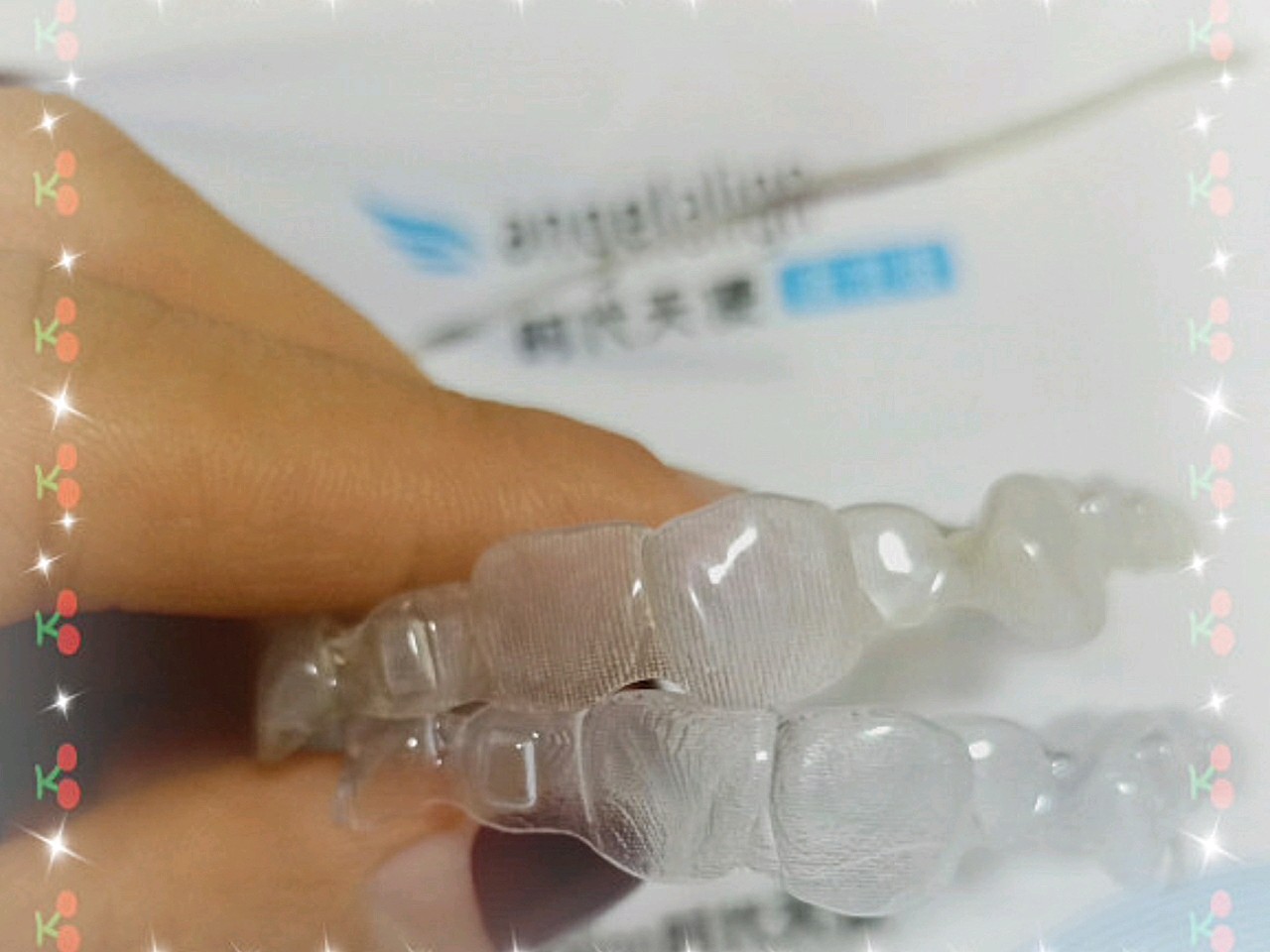 选时代天使标准版,上颌43,下颌42,有的人说隐形牙套很慢,我感觉戴到10