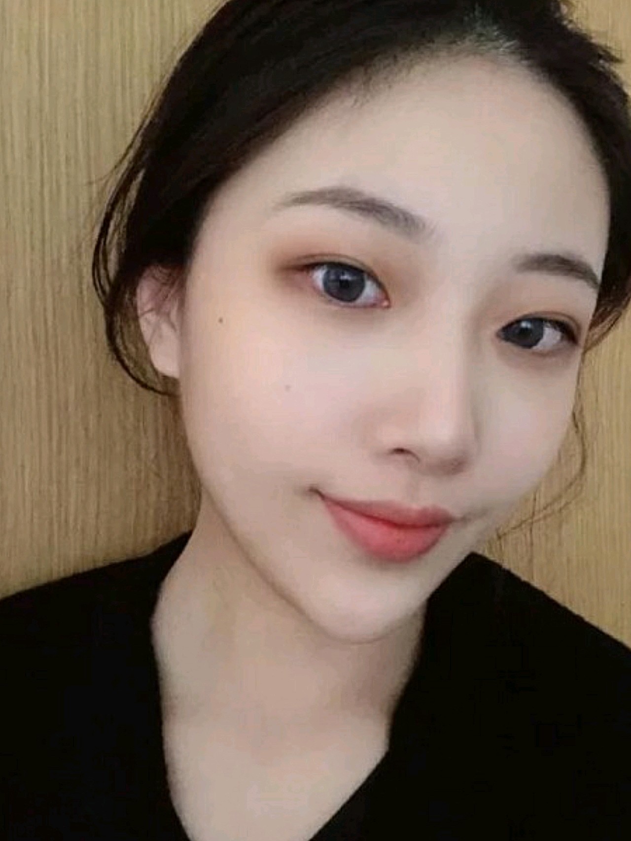 面诊的时候我还以为我这种鼻子只需要微调就可以了呢,_圈子-新氧美容