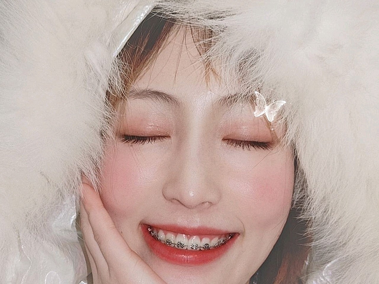 整牙变女神从一开始的百般不适,到后来被牙套磨破嘴_圈子-新氧美容