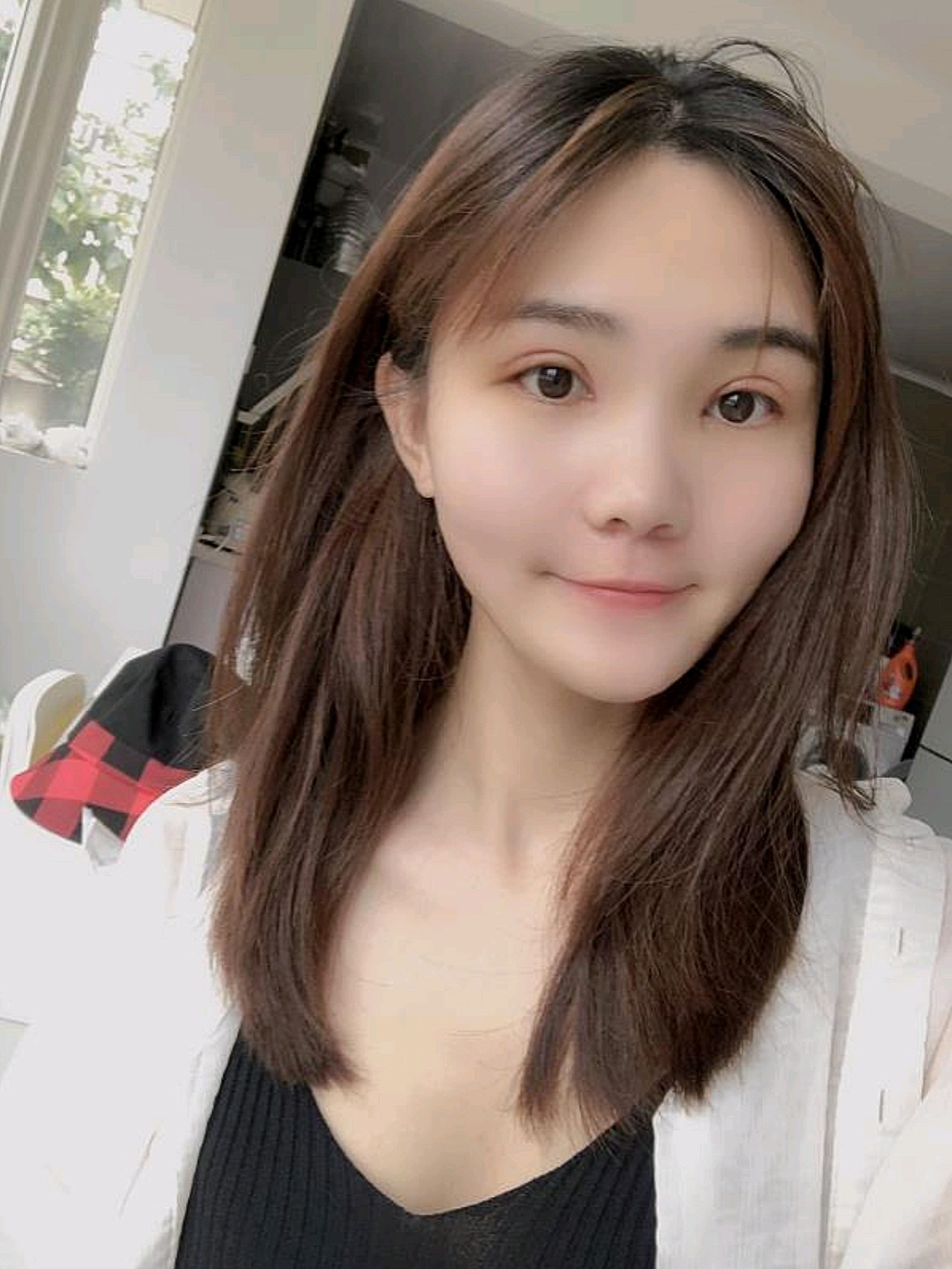 之前双眼皮切开的那条线已经结痂了,肉肉们在相互集合,开始慢慢要恢复