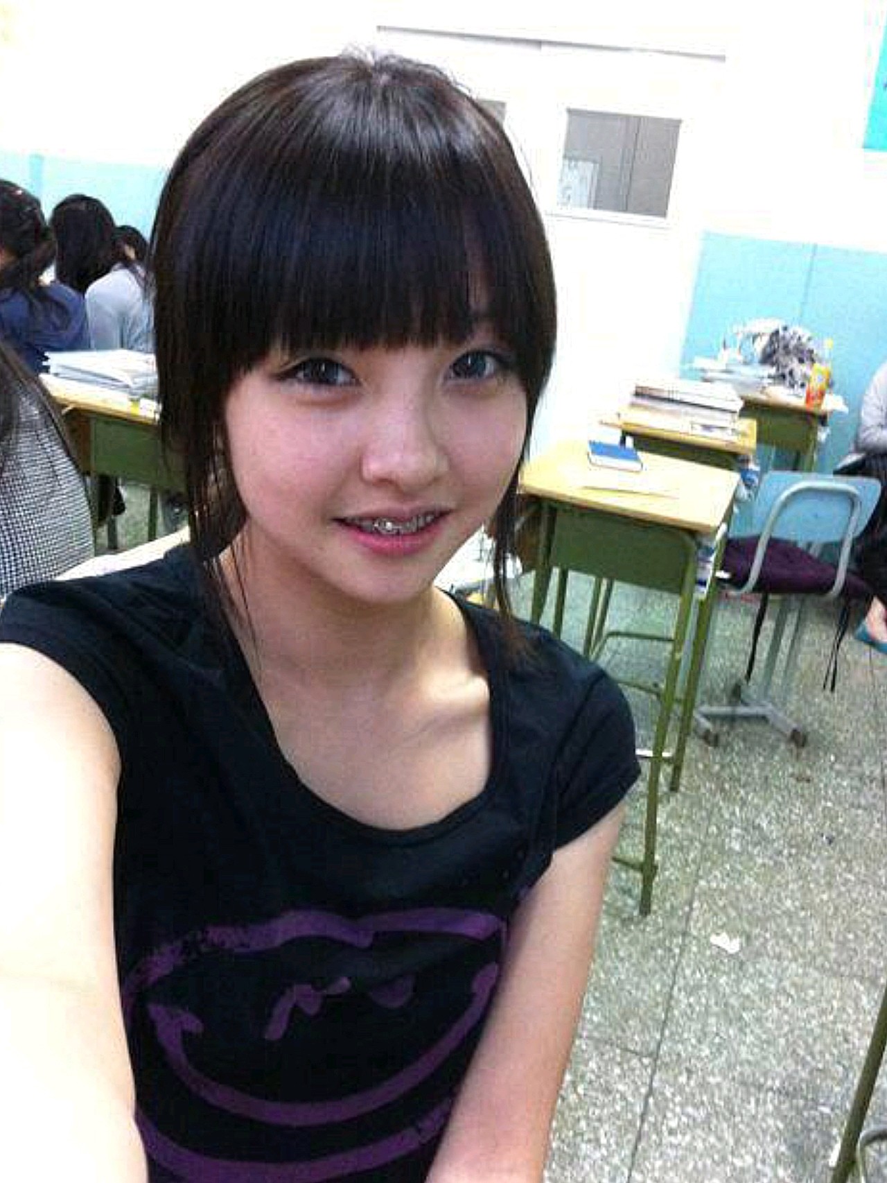 99满脸痘痘的豆得儿,居然王思聪的前女友,秦奋的现女_圈子-新氧美容