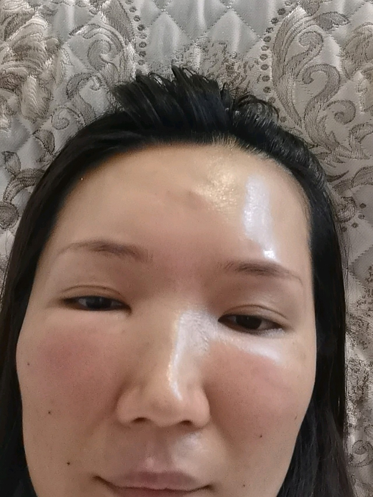 我只想说,以前打的立马变美,这边打成这样了,又说