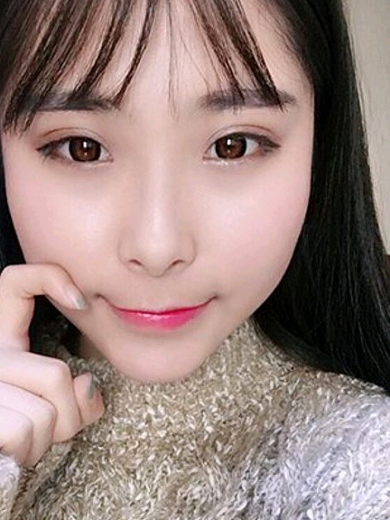 星妍的技术真的不错,院长的水平和医护人员都真的很好_圈子-新氧美容