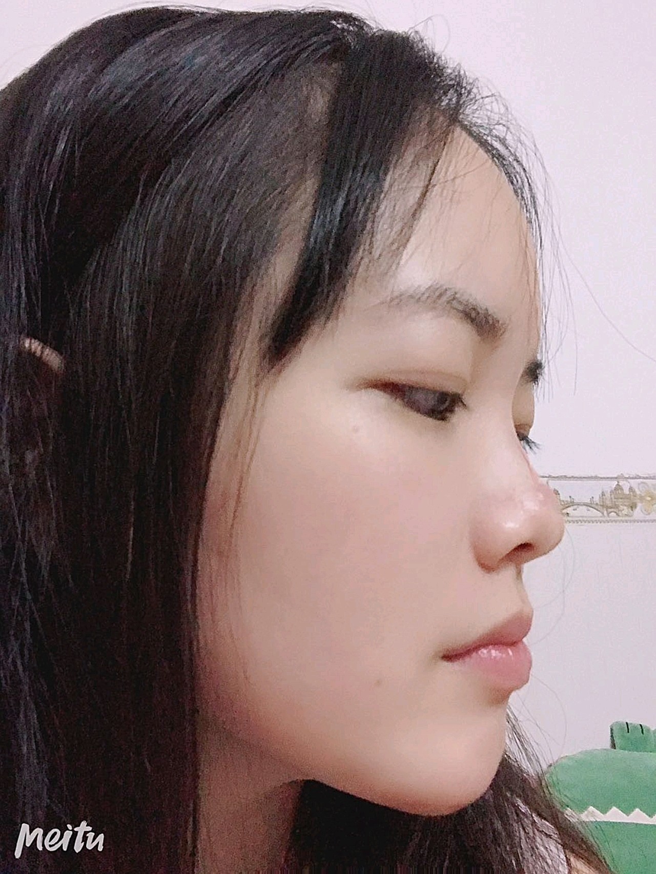 现在最明显的是面部的轮廓,自然又好看,而且皮肤变得_圈子-新氧美容