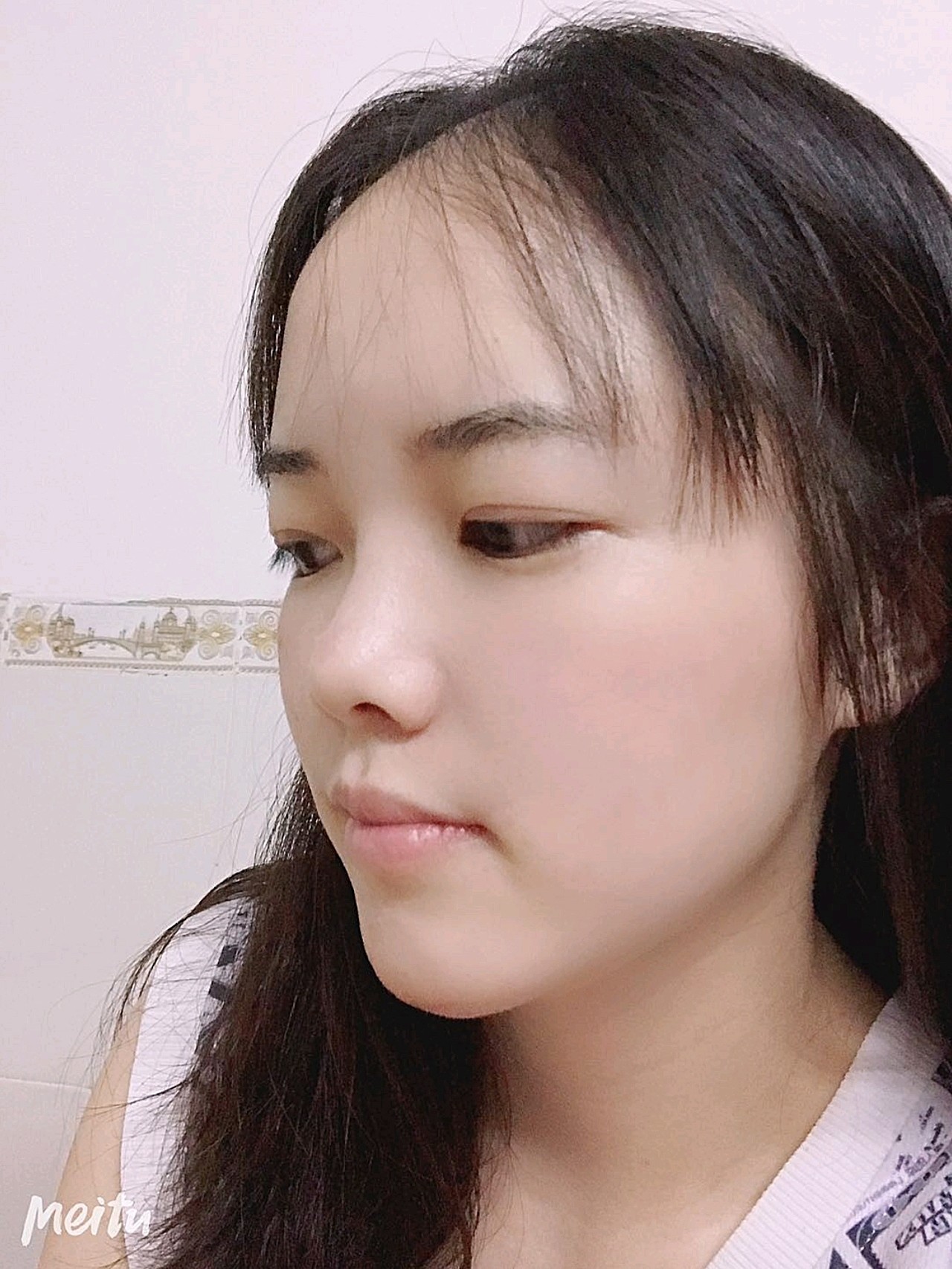 现在最明显的是面部的轮廓,自然又好看,而且皮肤变得_圈子-新氧美容