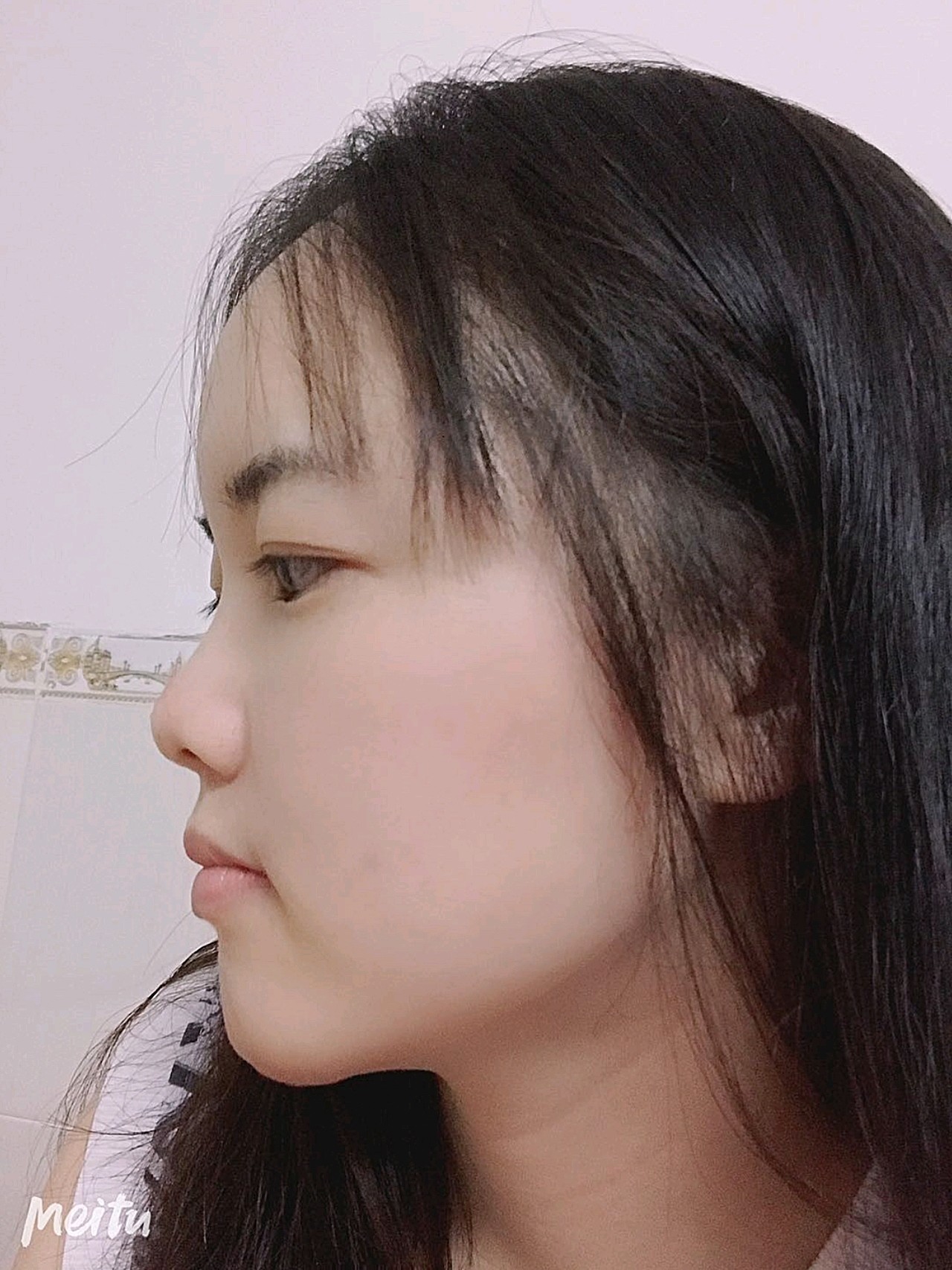 现在最明显的是面部的轮廓,自然又好看,而且皮肤变得_圈子-新氧美容