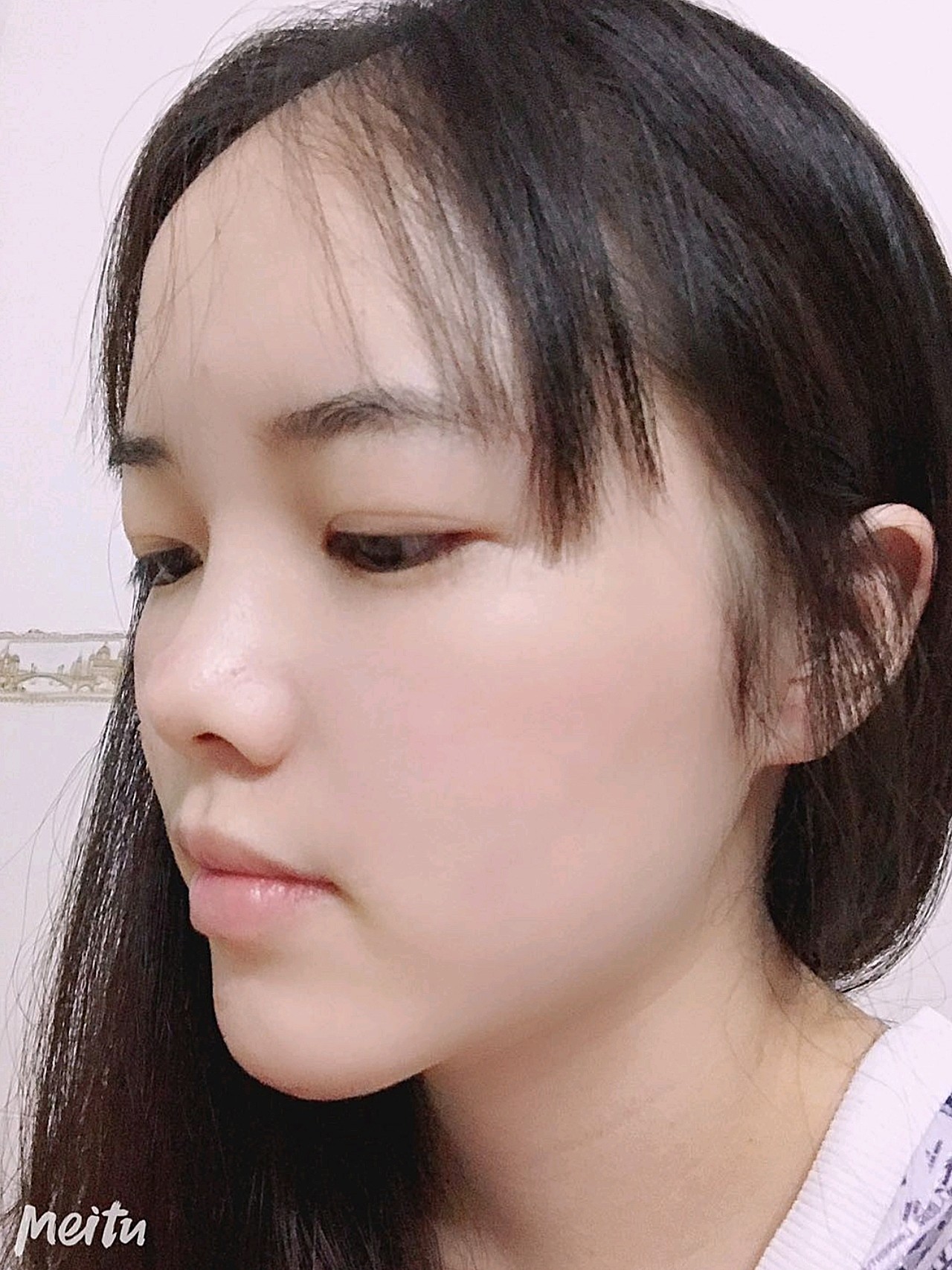 现在最明显的是面部的轮廓,自然又好看,而且皮肤变得_圈子-新氧美容