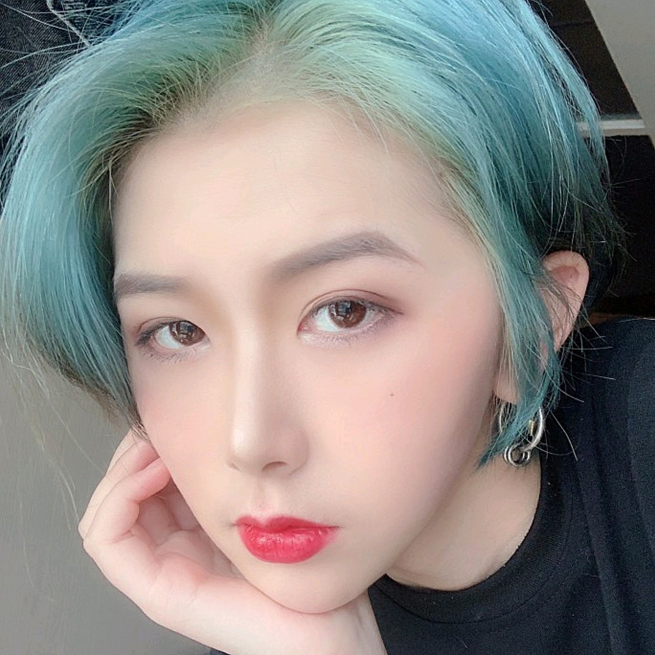 "牛鼻子"隆鼻后,照样变美女!