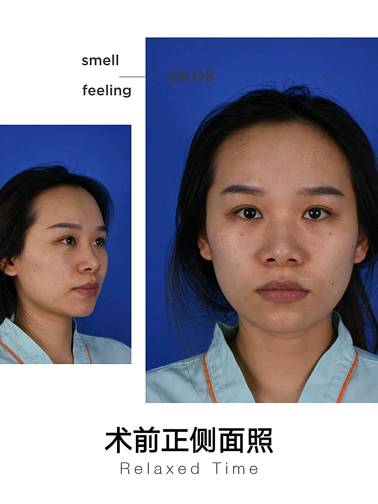 鼻子作为核心,起着协调面部五官的重要作用,具有很高的美学价值