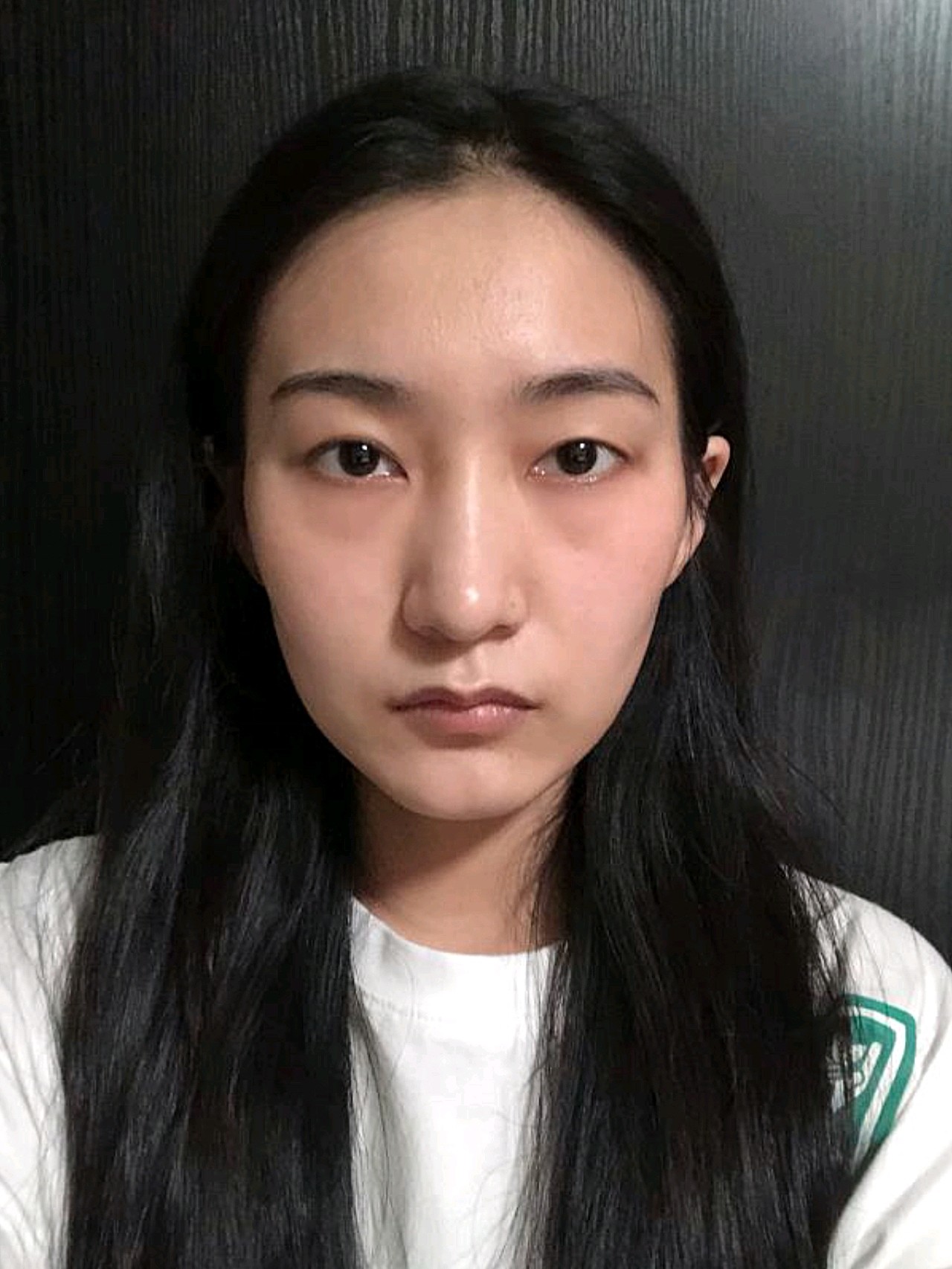 的眼睛属于标准的单眼皮,还伴有一点肿泡眼,整个眼_圈子-新氧美容整形