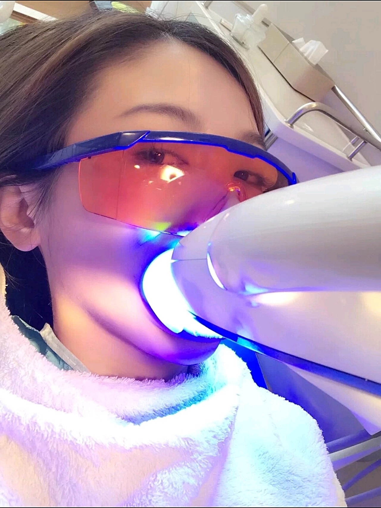 做冷光美白牙齿啦