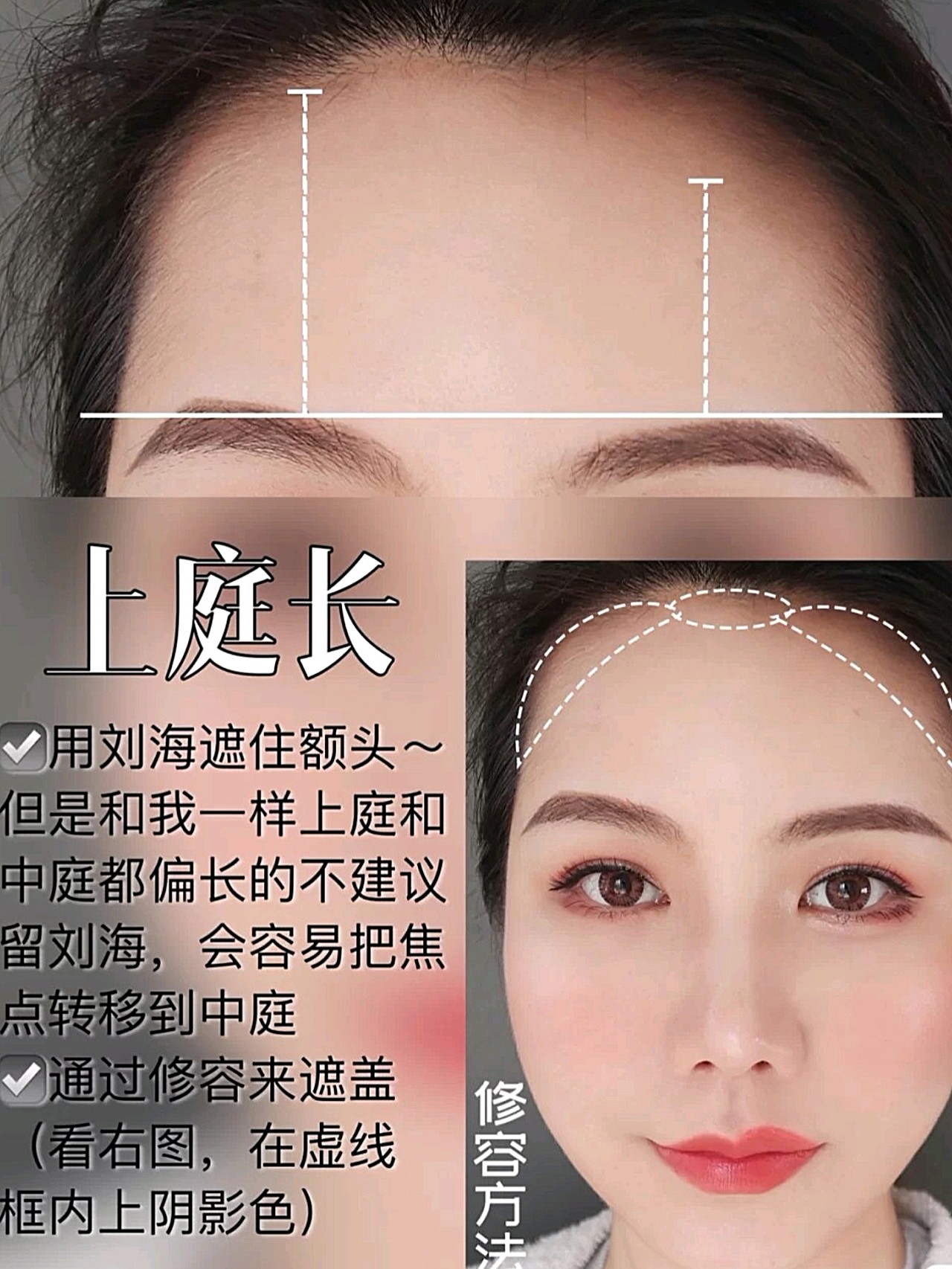 到鼻头为中庭;鼻尖到下巴为下庭; 上庭长上庭长主要表现在发际线高