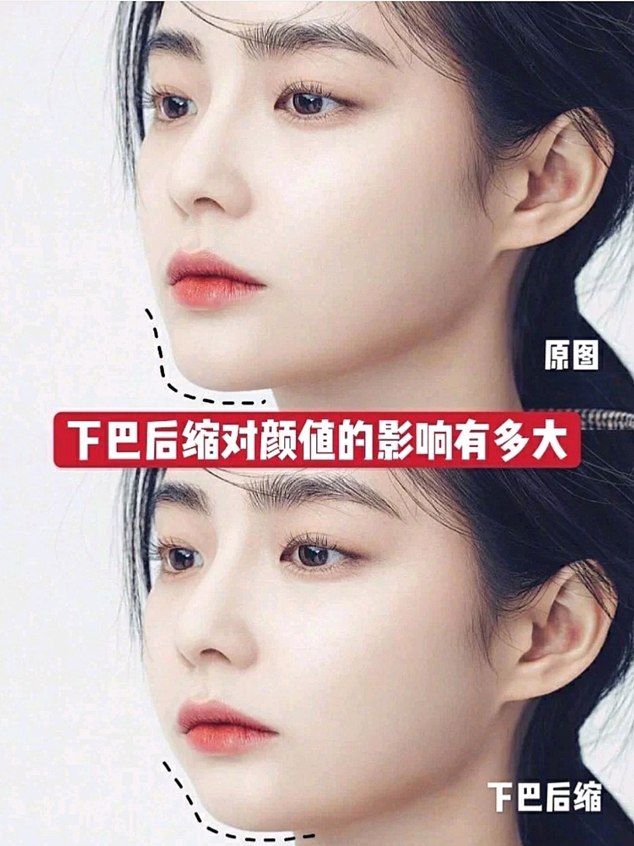 如何拯救短缩下巴对颜值的影响有多大