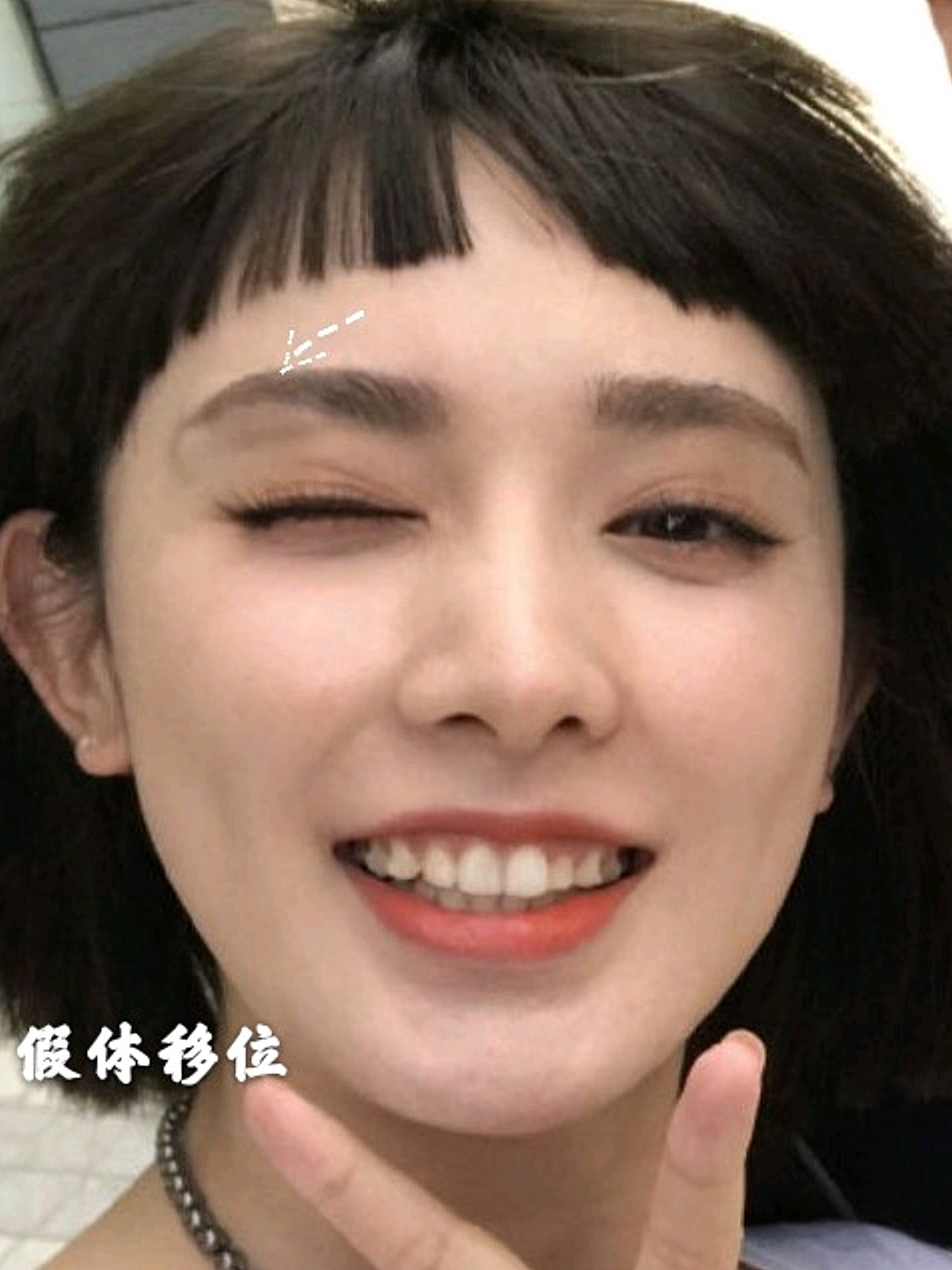 上篇说了,彭小苒最大的颜值bug就是凸嘴,通过牙齿_圈子-新氧美容整形