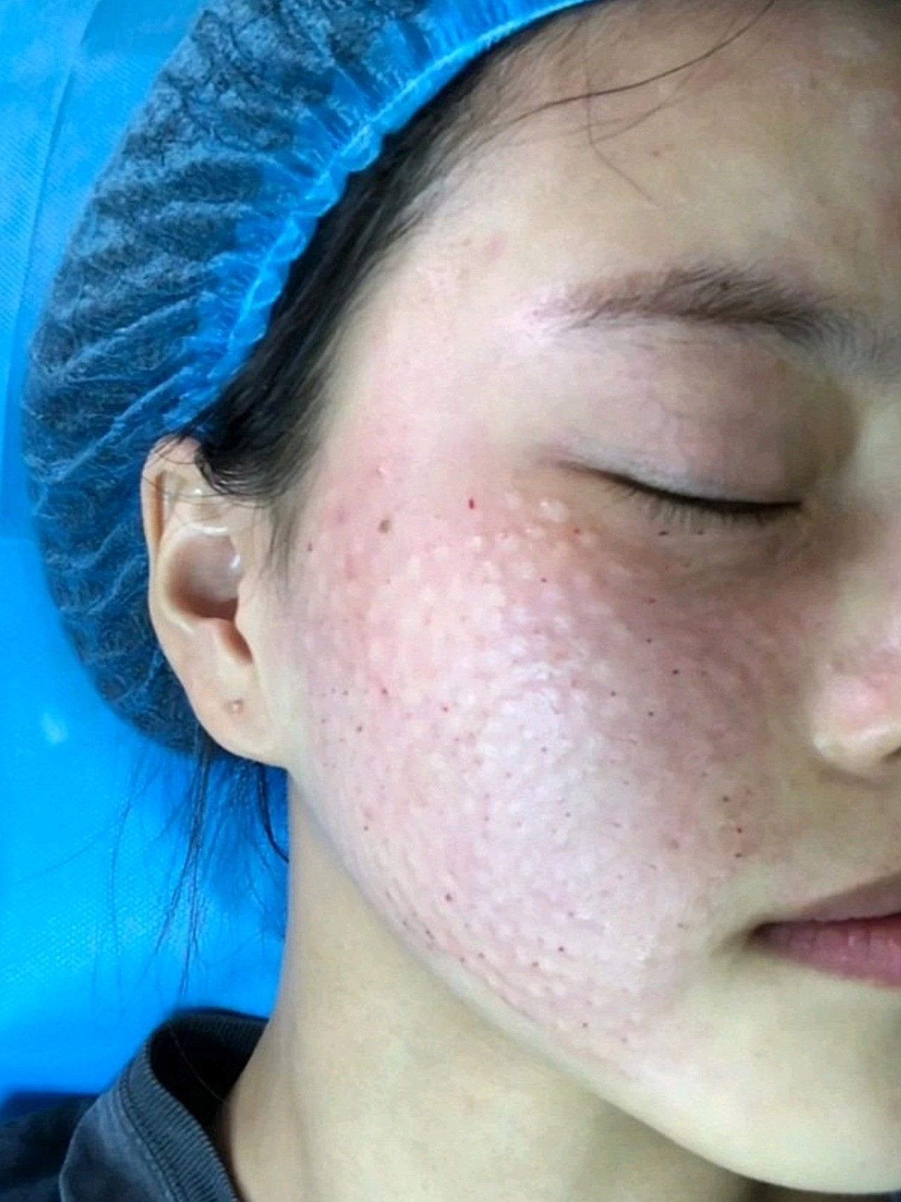 找医生手打的,医院里的人说也可以手打的,两只,没