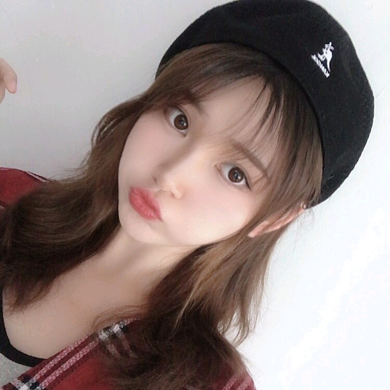 嘟嘟唇很可爱,非常感谢王琪海院长帮我做的嘟嘟唇,没_圈子-新氧美容