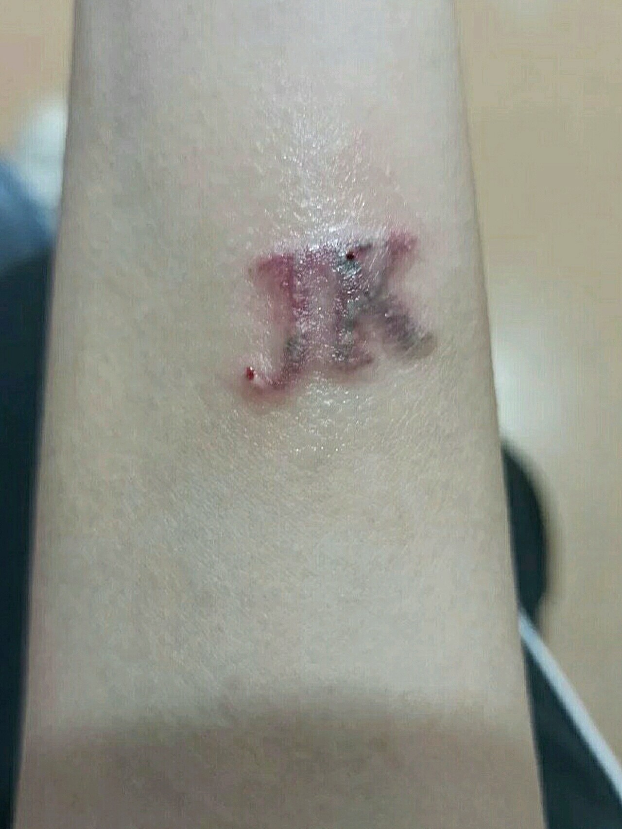 拖了很久的第二次洗纹身来啦!