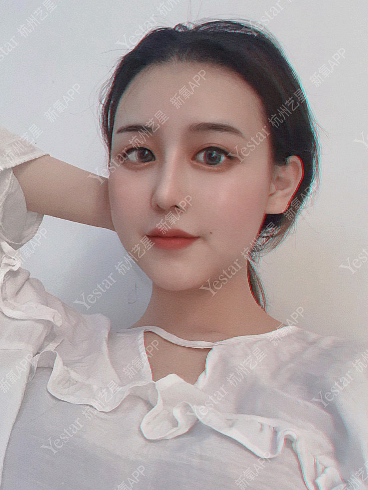 隆鼻后鼻型真的适合你吗