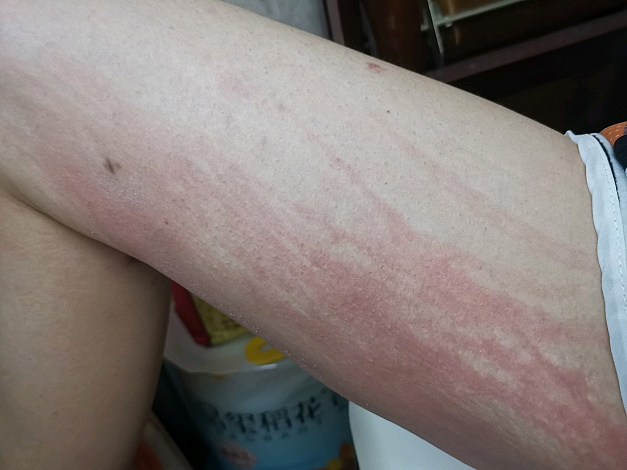 又是要被痒死的一瞬间