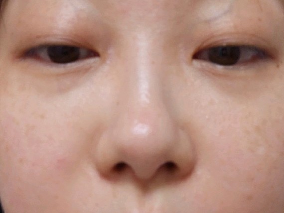 图片无美颜,一千多度近视的金鱼眼让我戴隐形都得带个框架要不照镜子