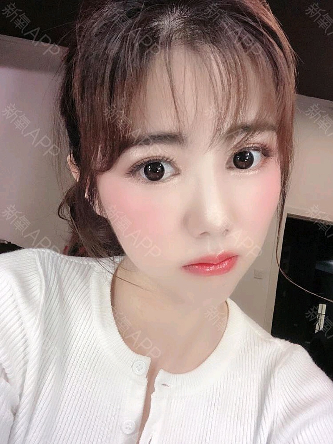 好久没来更新日记啦,现在来说一下做了三次光子嫩肤后_圈子-新氧美容