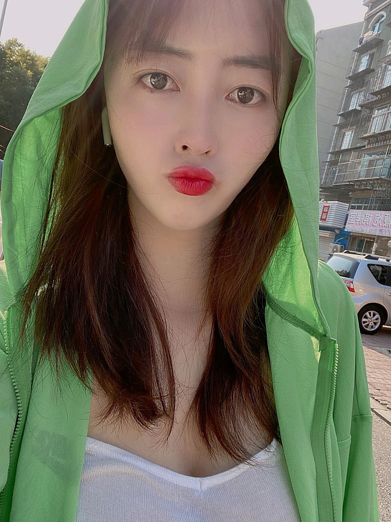 这是我刚在董萍整形做完双眼皮 全鼻观,苹果肌,下巴_圈子-新氧美容