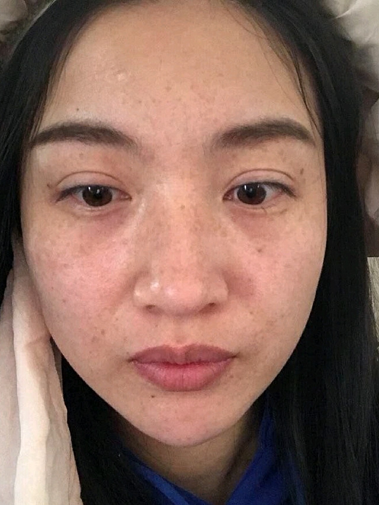 年龄大了,脸上的斑点就越来越多,虽然颜色都很淡,但满脸都是