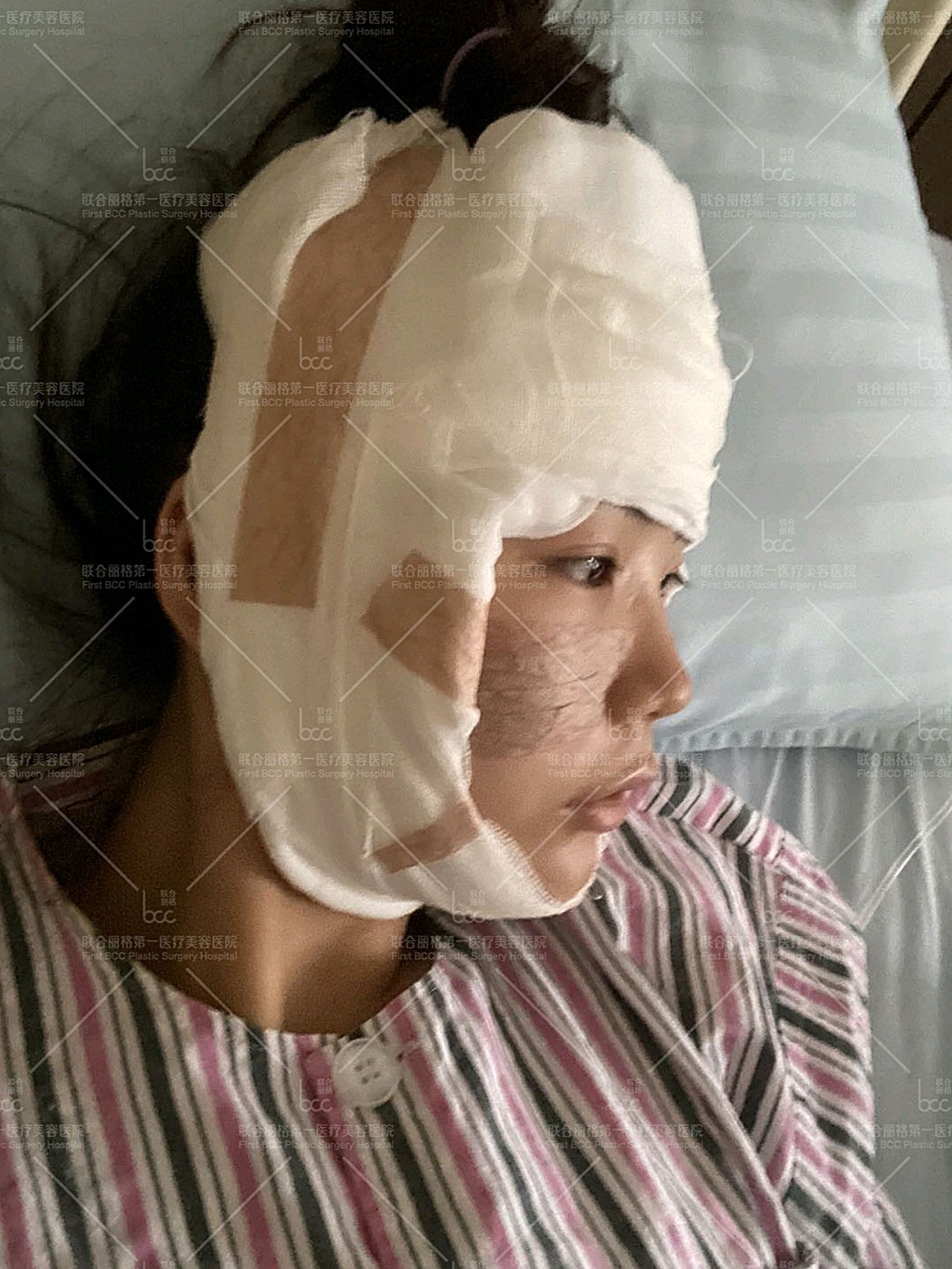 手术完过了麻药劲还是挺难受的,还好医院的护士24小时在岗,会时不时的