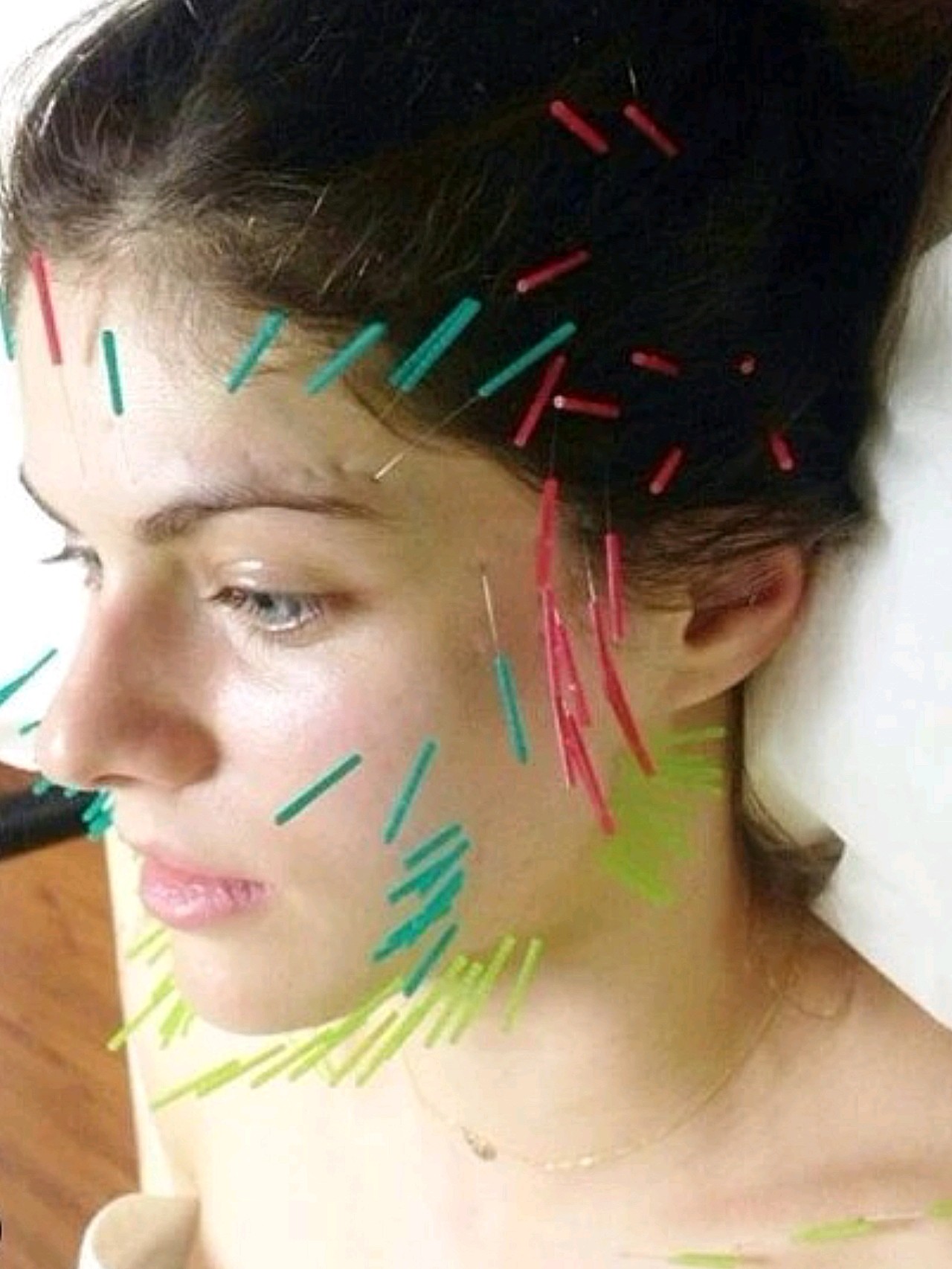 哇塞,外国人流传的针灸美颜法,看着脸好痛啊啊啊啊_圈子-新氧美容整形