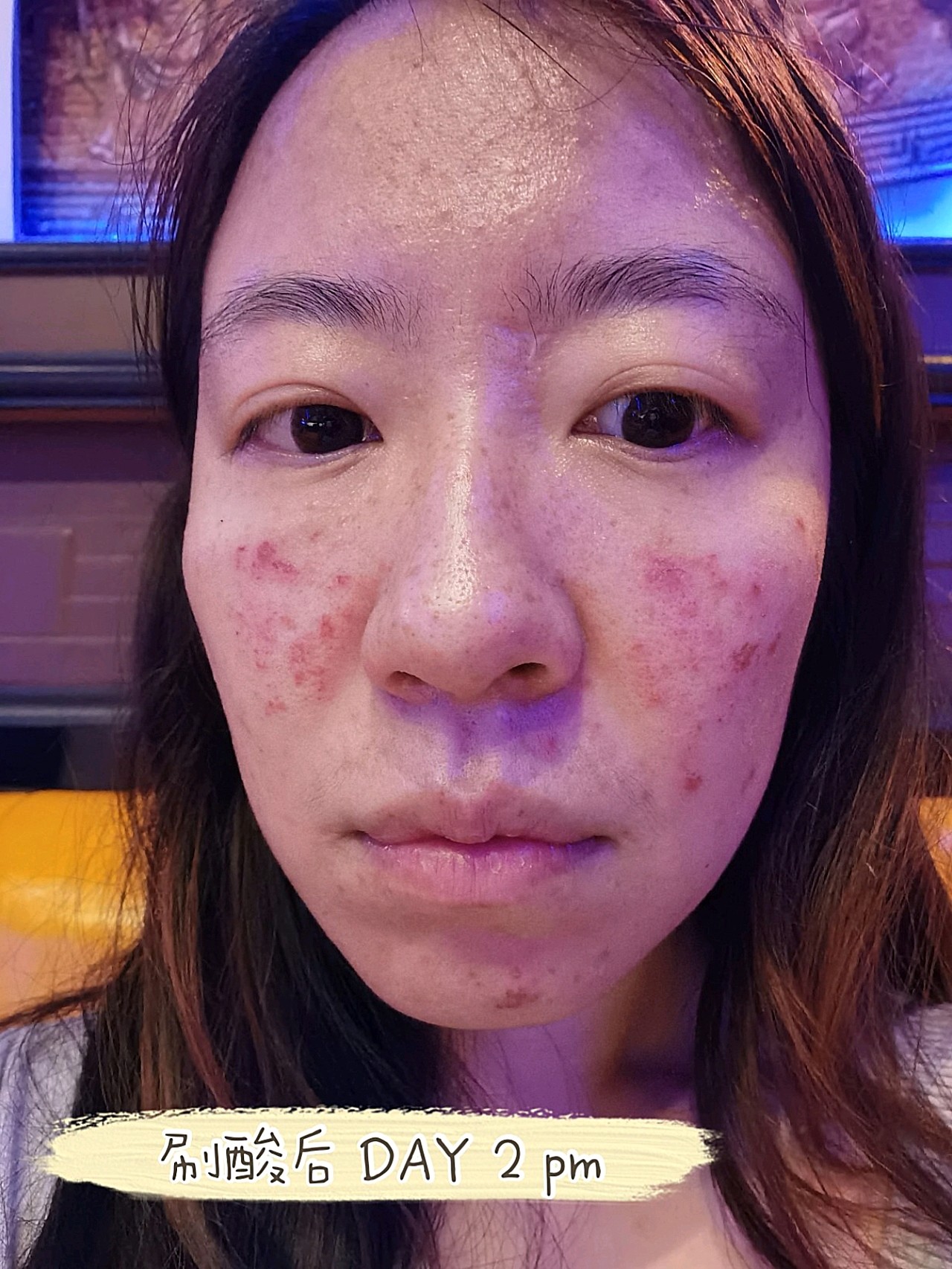 迪玛丝缇千人刷酸体验