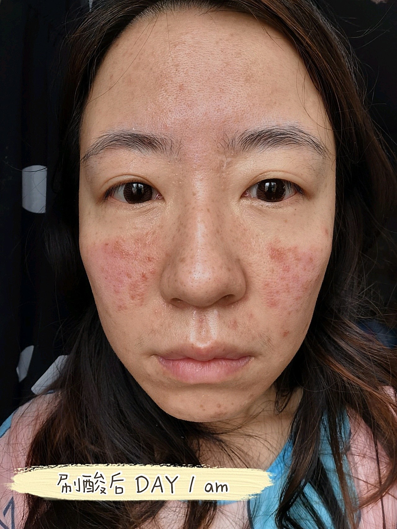 迪玛丝缇千人刷酸体验