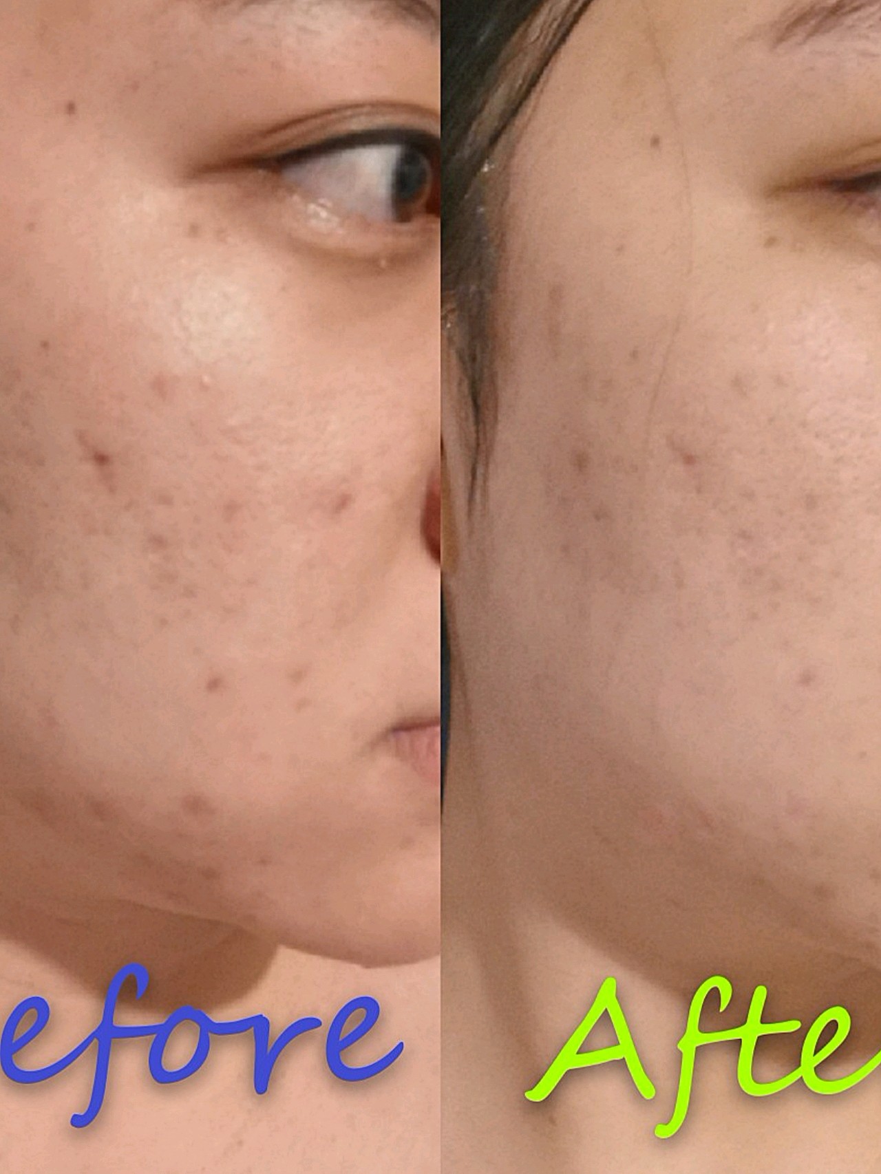 迪玛丝缇千人刷酸体验