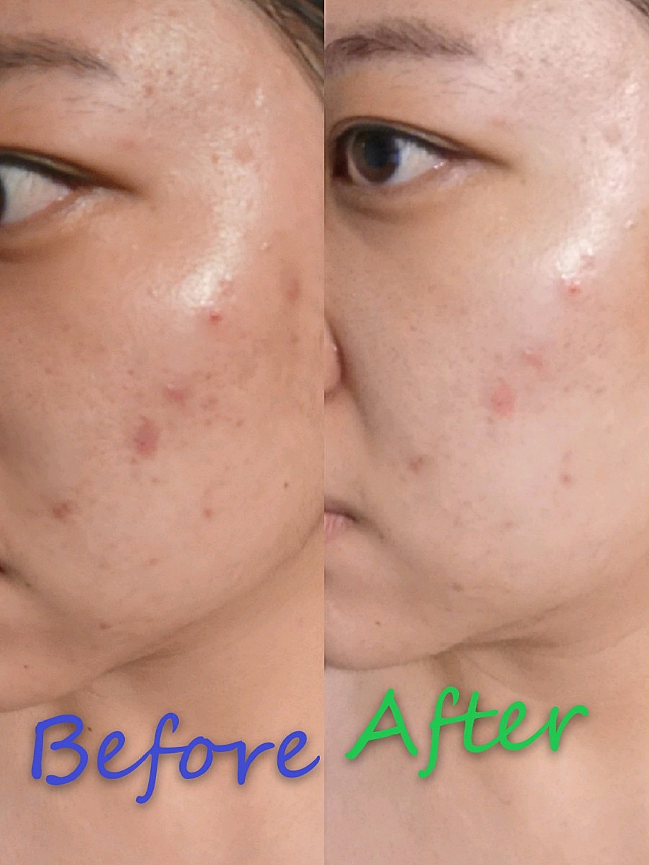 迪玛丝缇千人刷酸体验