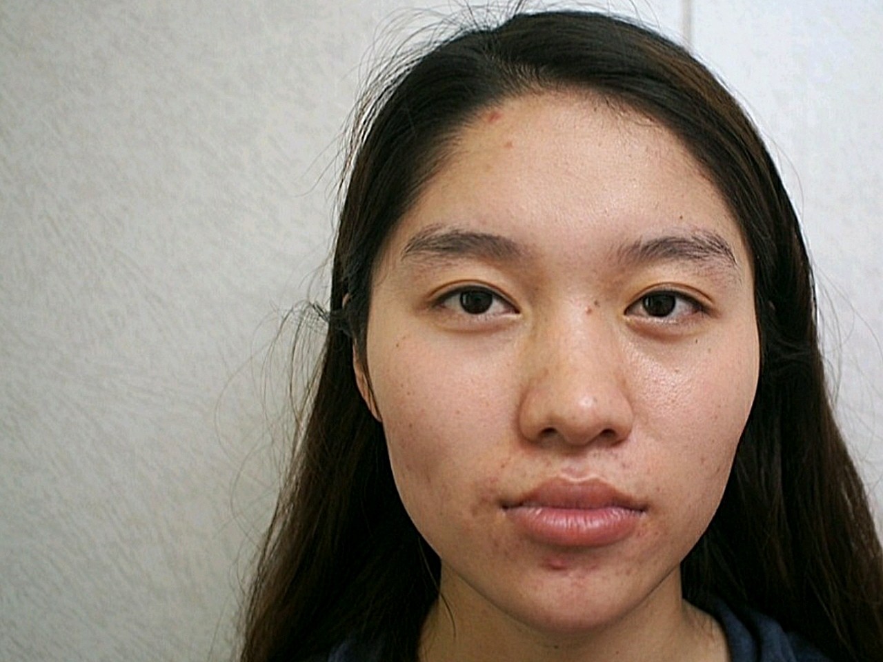 从扁平脸到高级脸,鼻子带来的改变是不容忽视的,颜值_圈子-新氧美容