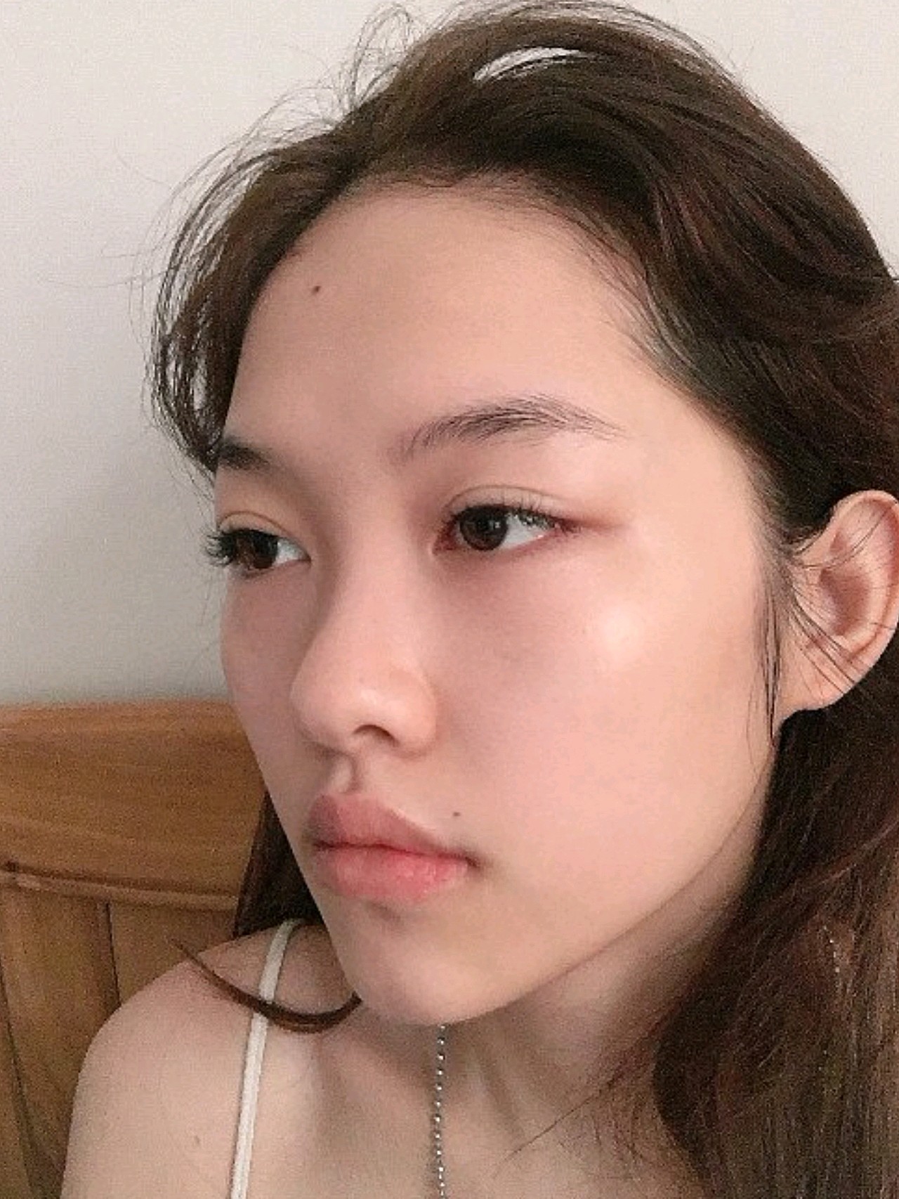 术前:亲们发现没有,我的鼻子,居然没有山根 ~ 今_圈子-新氧美容整形