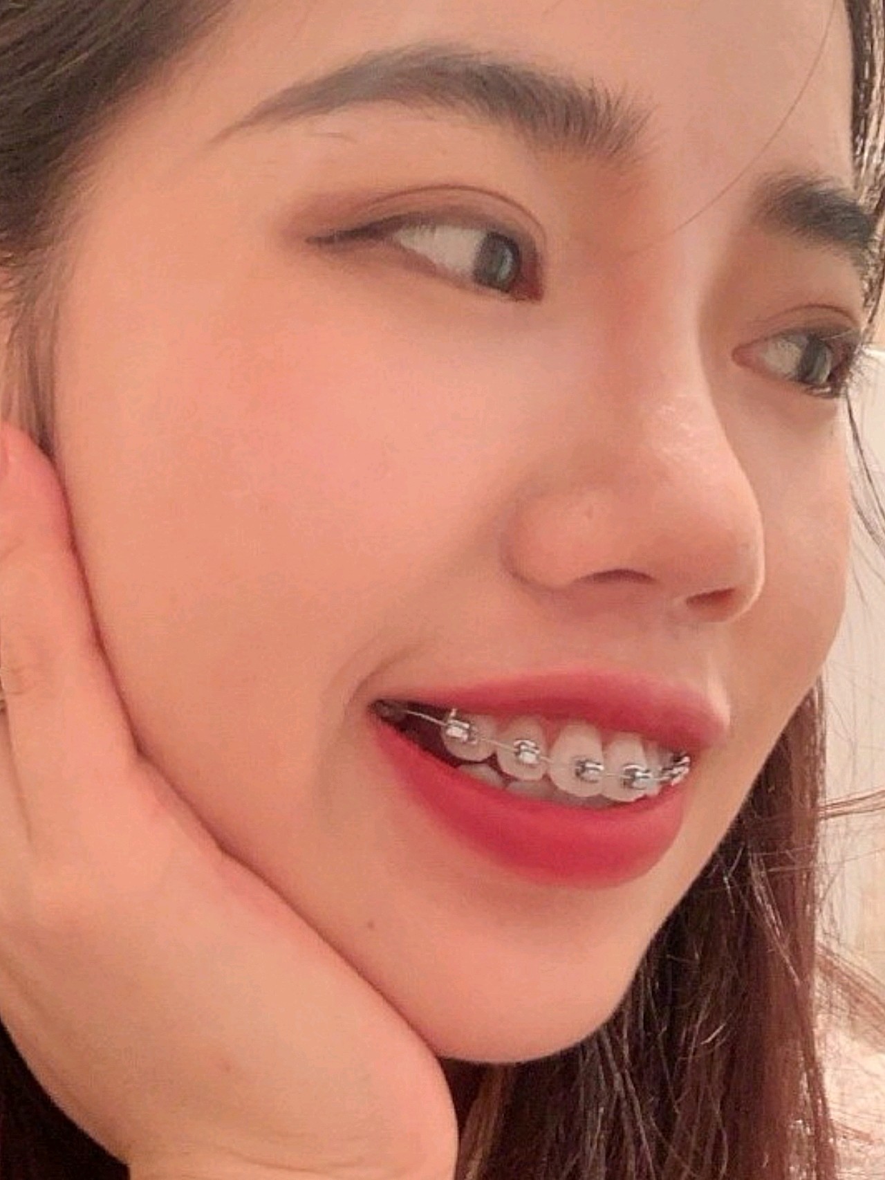 牙齿有些微微的龅牙,从小就这样,虽然现在我已经成为_圈子-新氧美容