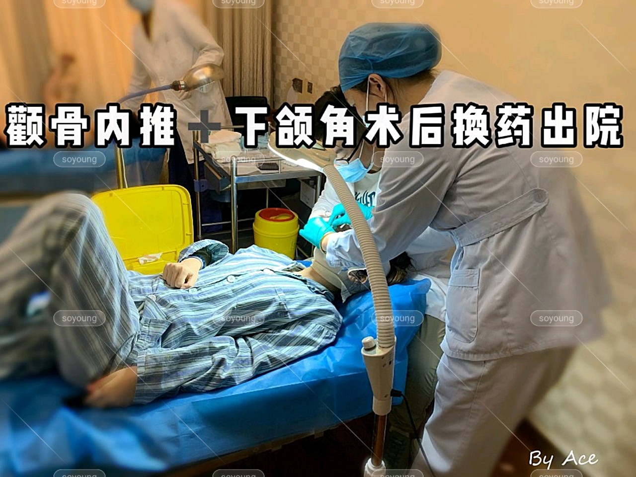 關於磨骨的恢復期98很多寶_圈子-新氧美容整形