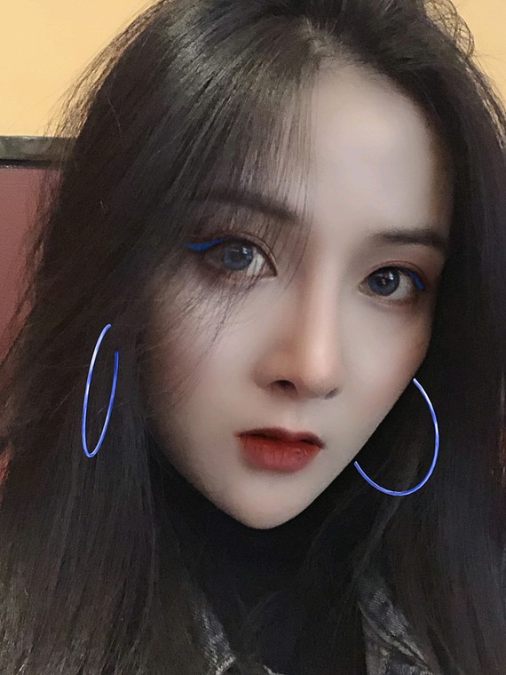 侧面对比真的太强烈了吧,我现在好想把额头也打两针哦_圈子-新氧美容