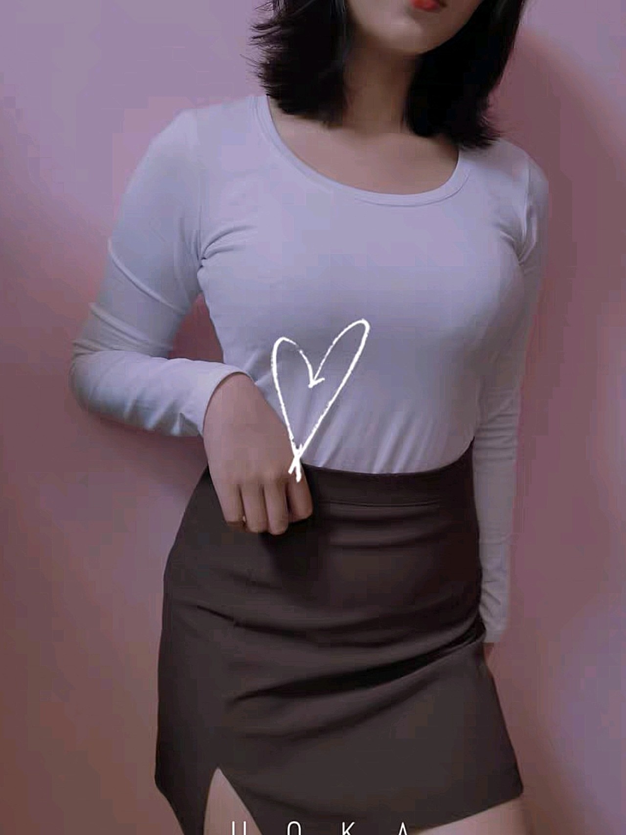 胸比刚做完的时候软多了,已经可以聚沟了,侧着睡的_圈子-新氧美容整形