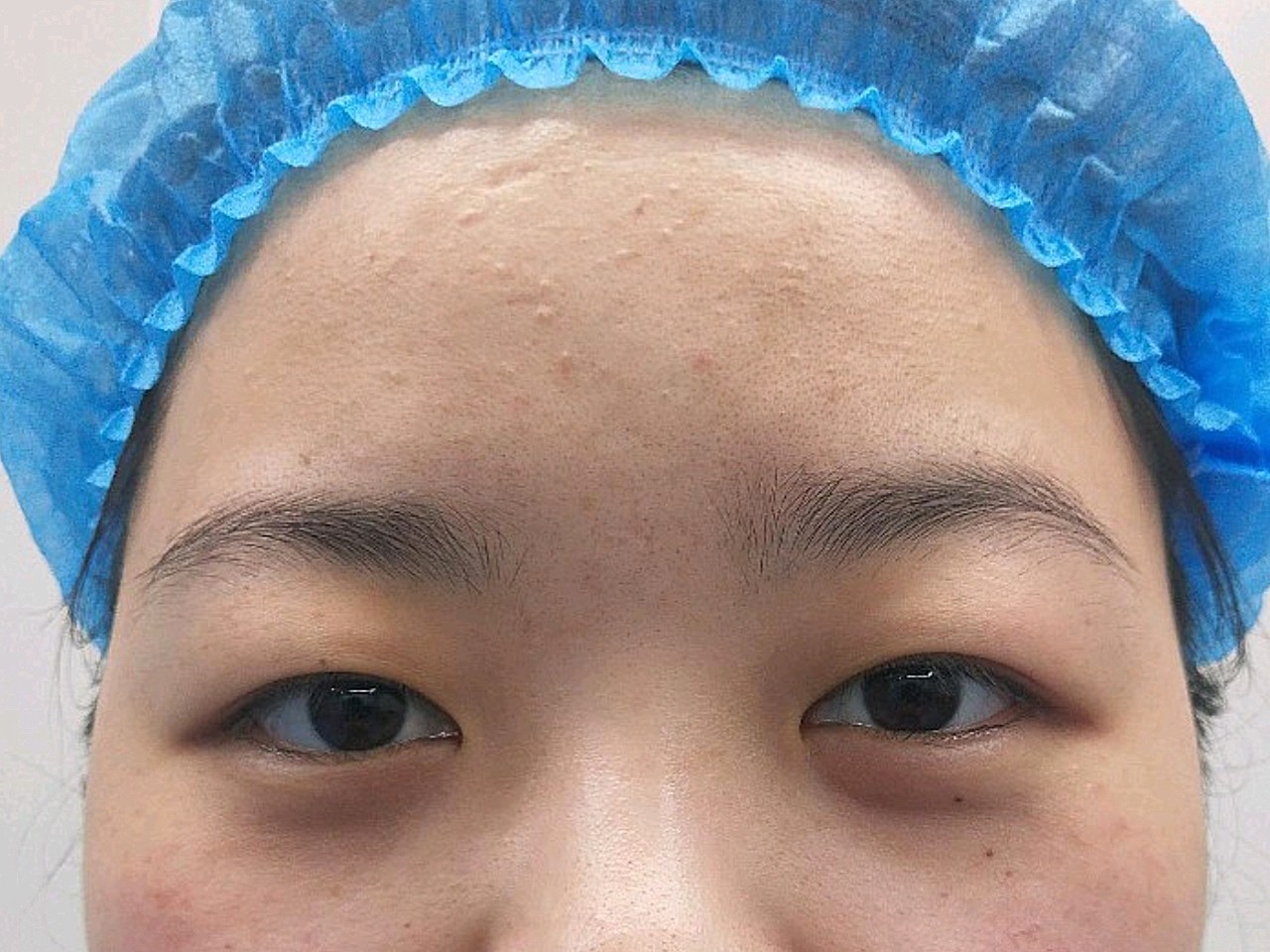 眼睛增大程度:毫不夸张的说 视觉上翻倍!