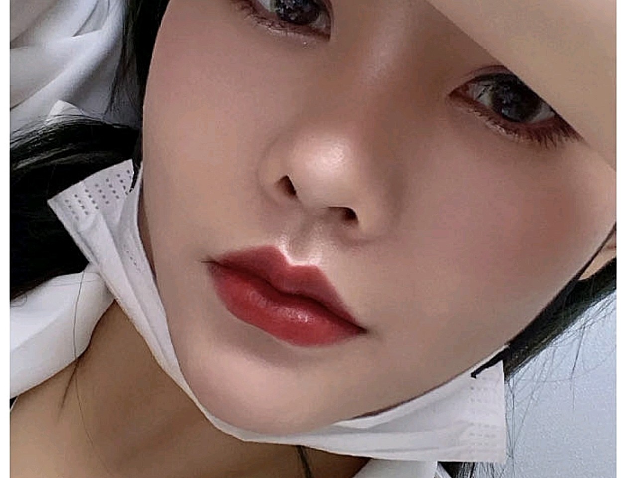 今年一月份的时候去做了m唇,很开心,因为想了太久了_圈子-新氧美容