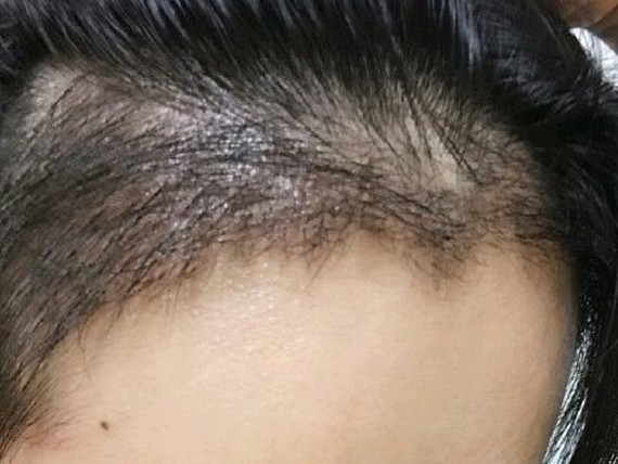 前边种植的头发长的很好